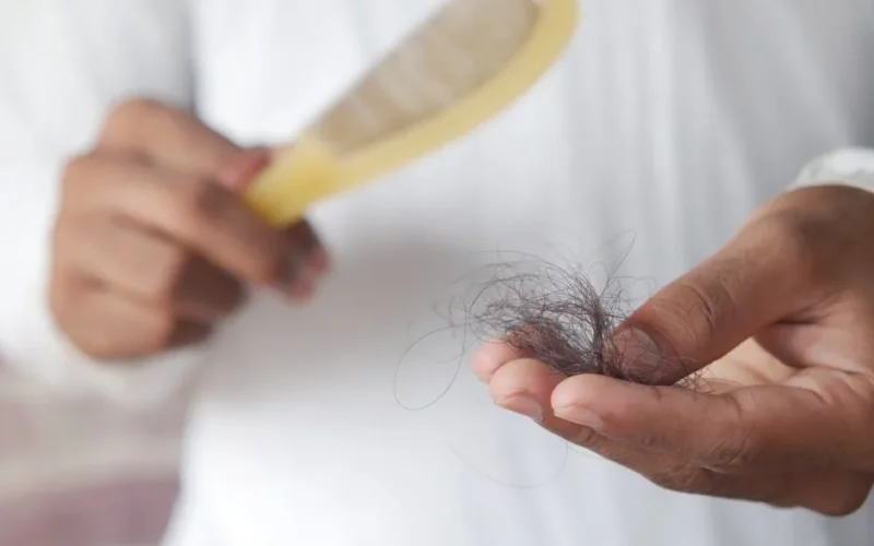 A detailed image showing hair loss with a comb in hand, symbolizing alopecia and related issues.