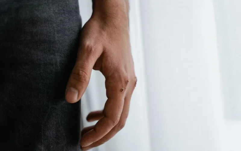 A close-up of a human hand with a small wound against a soft background.