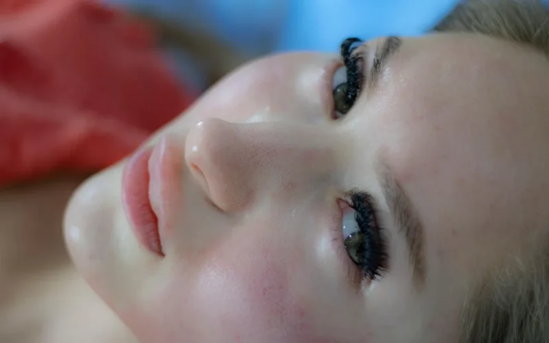 kobieta, skincare, zabieg na twarz, dermatologia, blizny po trądziku, skincare, dermatologia, dermatologia, dermatologia, dermatologia, dermatologia