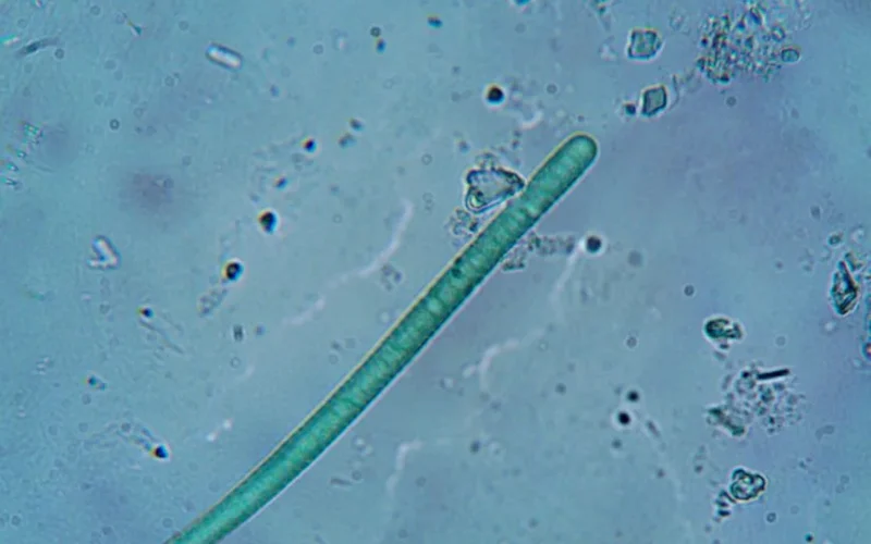 Close-up microscopic image showcasing a cyanobacteria strand, revealing intricate cell structures.
